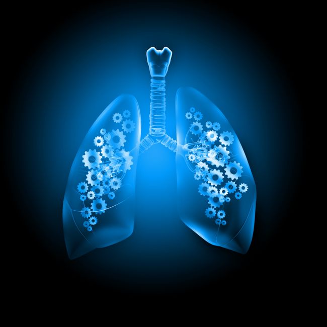 Subsidie voor betere opsporing van teruggekeerde longkanker